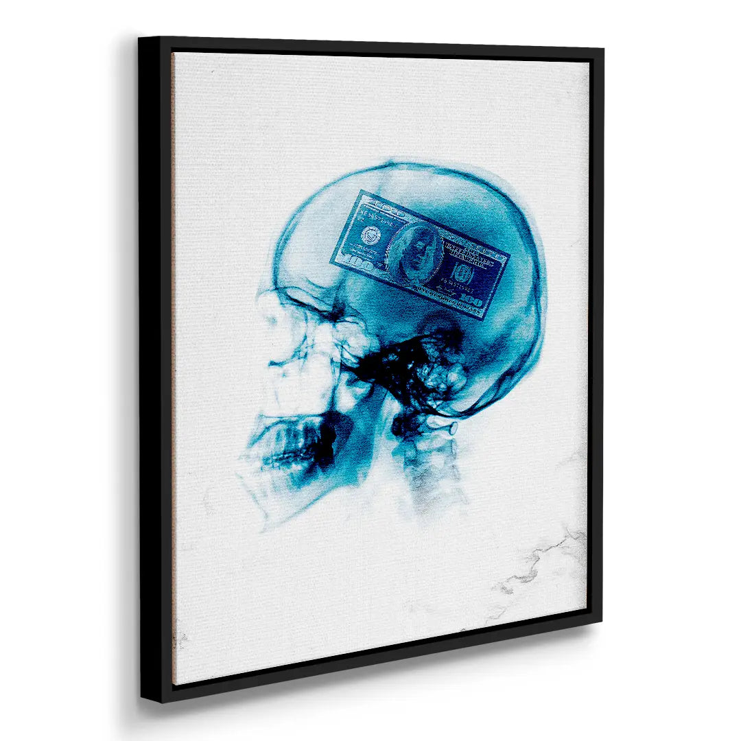 X-Ray Money | Image